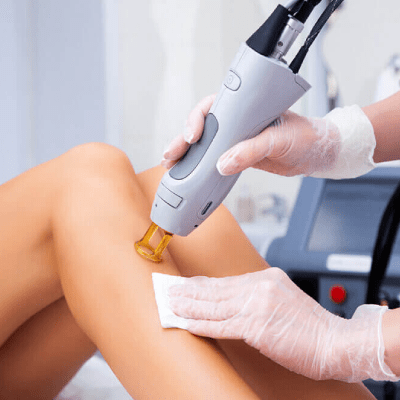 LEG LASER HAIR REMOVAL
